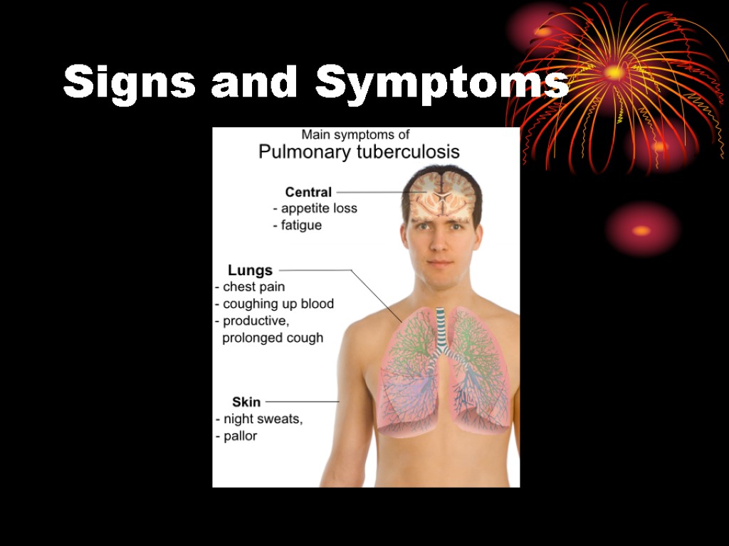 Signs and Symptoms